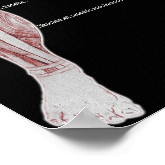 筋解剖学 ポスター (角)