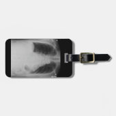 箱X光線の~の荷物のラベル ラゲッジタグ (正面横)