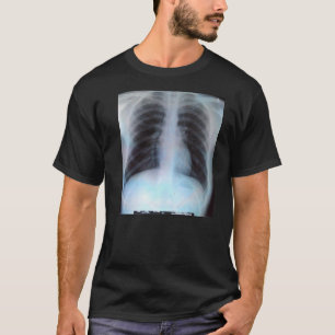 箱X光線のTシャツ Tシャツ
