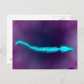 精子の骨構造を示す顕微鏡的見解 ポストカード (正面/裏面)