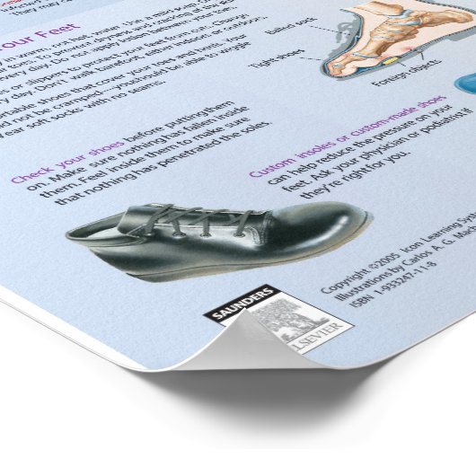 糖尿病足気にポスタ – Netter Chart ポスター (角)