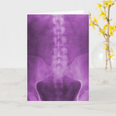 紫色のデジタルX線の芸術の挨拶状 カード (黄色い花)