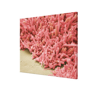 細菌のプラク形成、着色されたスキャン キャンバスプリント