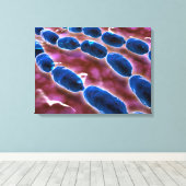 細菌性肺炎の顕微鏡的見解1 キャンバスプリント (インサイチュ (ウッドフロア))