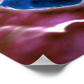 細菌性肺炎の顕微鏡的見解1 ポスター (角)