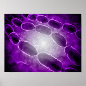 細菌性肺炎の顕微鏡的見解2 ポスター (正面)