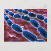 細菌性肺炎の顕微鏡的観察 1 ポストカード (正面)