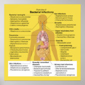 細菌感染の概要 ポスター (正面)