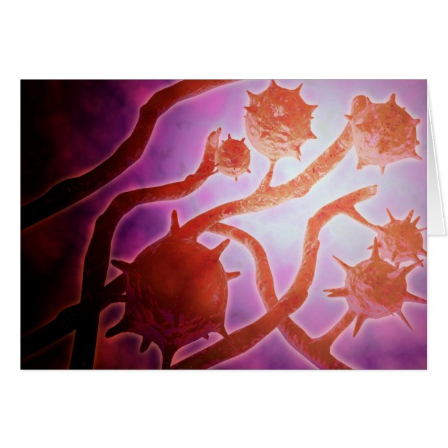 組織形成症の顕微鏡的見解 (正面横)