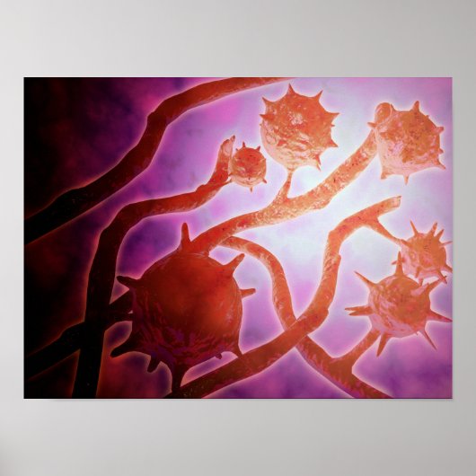 組織形成症の顕微鏡的見解 ポスター (正面)