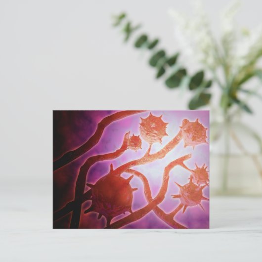 組織形成症の顕微鏡的見解 ポストカード (スタンド正面)