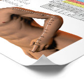 経絡フランスの点図 ポスター (角)