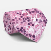 網膜腫瘍を示すネクタイ ネクタイ (ロール)