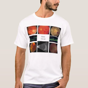 網膜 Tシャツ