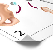 総お尻置換手術プリント ポスター (角)