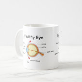 緑内障と健康な目のための眼図 コーヒーマグカップ (正面左)