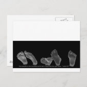 美しい足 ポストカード (正面/裏面)