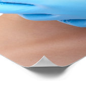 美的医師によるボトックスとフィラー注射 ポスター (角)