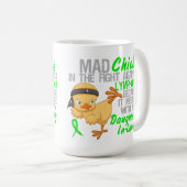 義理の娘3のリンパ腫と台なしになる気違いのひよこ コーヒーマグカップ (正面右)