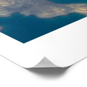 耳造影 ポスター (角)