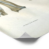 肘と腕の解剖学的プリントの関節 ポスター (角)