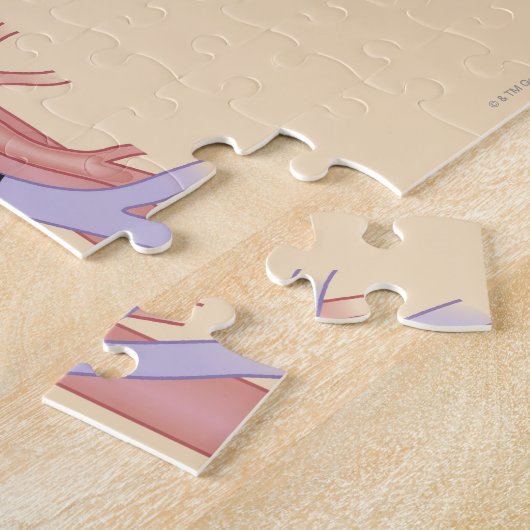 肝移植手術 ジグソーパズル (側面)