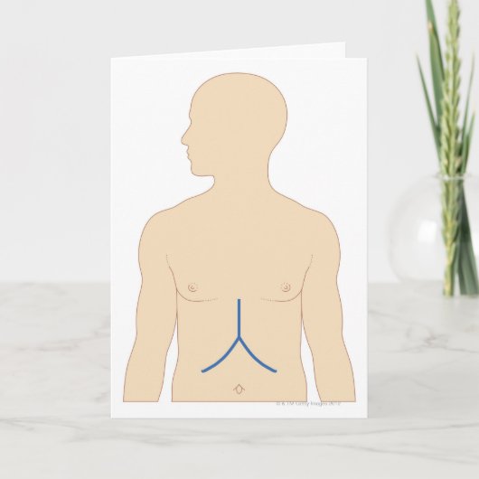 肝移植 カード (正面)