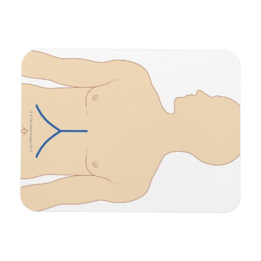 肝移植 マグネット (横)