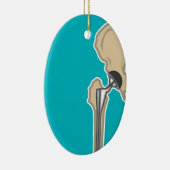 股関節の取り替え セラミックオーナメント (右)
