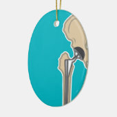 股関節の取り替え セラミックオーナメント (左)