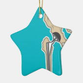 股関節の取り替え セラミックオーナメント (左)