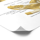 肩解剖図の筋肉の靭帯 ポスター (角)