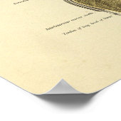 肩関節靱帯解剖学プリント ポスター (角)