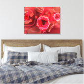 肺の中のHIVウイルスの顕微鏡観察 キャンバスプリント (インサイチュ (寝室))