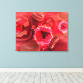 肺の中のHIVウイルスの顕微鏡観察 キャンバスプリント (インサイチュ (ウッドフロア))