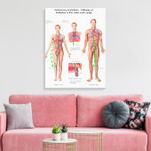 肺塞栓症、塞栓経路 キャンバスプリント (インサイチュ (リビング))