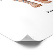 肺塞栓症、塞栓経路 ポスター (角)