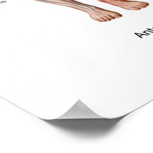 肺塞栓症、塞栓経路 ポスター (角)