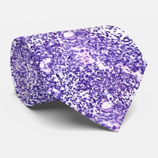 肺小さい細胞の癌腫 ネクタイ (ロール)