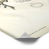 肺気管支ヴィンテージ構造プリント ポスター (角)