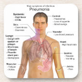 肺炎の徴候の図表 コースター (正面)