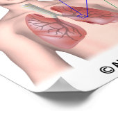 肺疾患COPD標識ポスター ポスター (角)