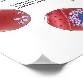 肺結核ポスターの進行 ポスター (角)