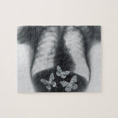 胃の蝶のX線 ジグソーパズル (横)