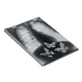 胃の蝶のX線 ノートブック (右側)