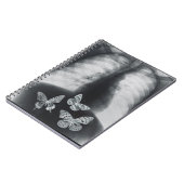 胃の蝶のX線 ノートブック (左側)