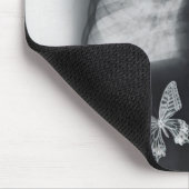 胃の蝶のX線 マウスパッド (コーナー)