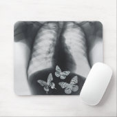 胃の蝶のX線 マウスパッド (マウス)