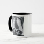 胃の蝶のX線 マグカップ (正面左)