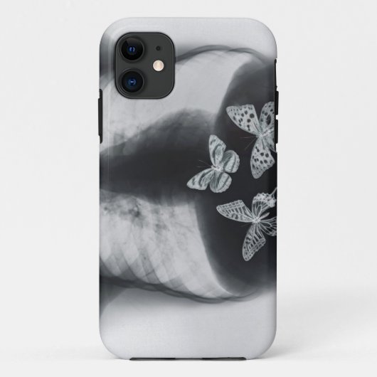 胃の蝶のX線 Case-Mate iPhoneケース (裏面)